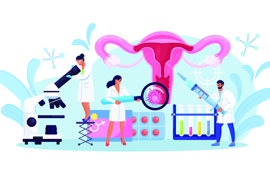 Illustration of healthcare professional's treating cervical cancer